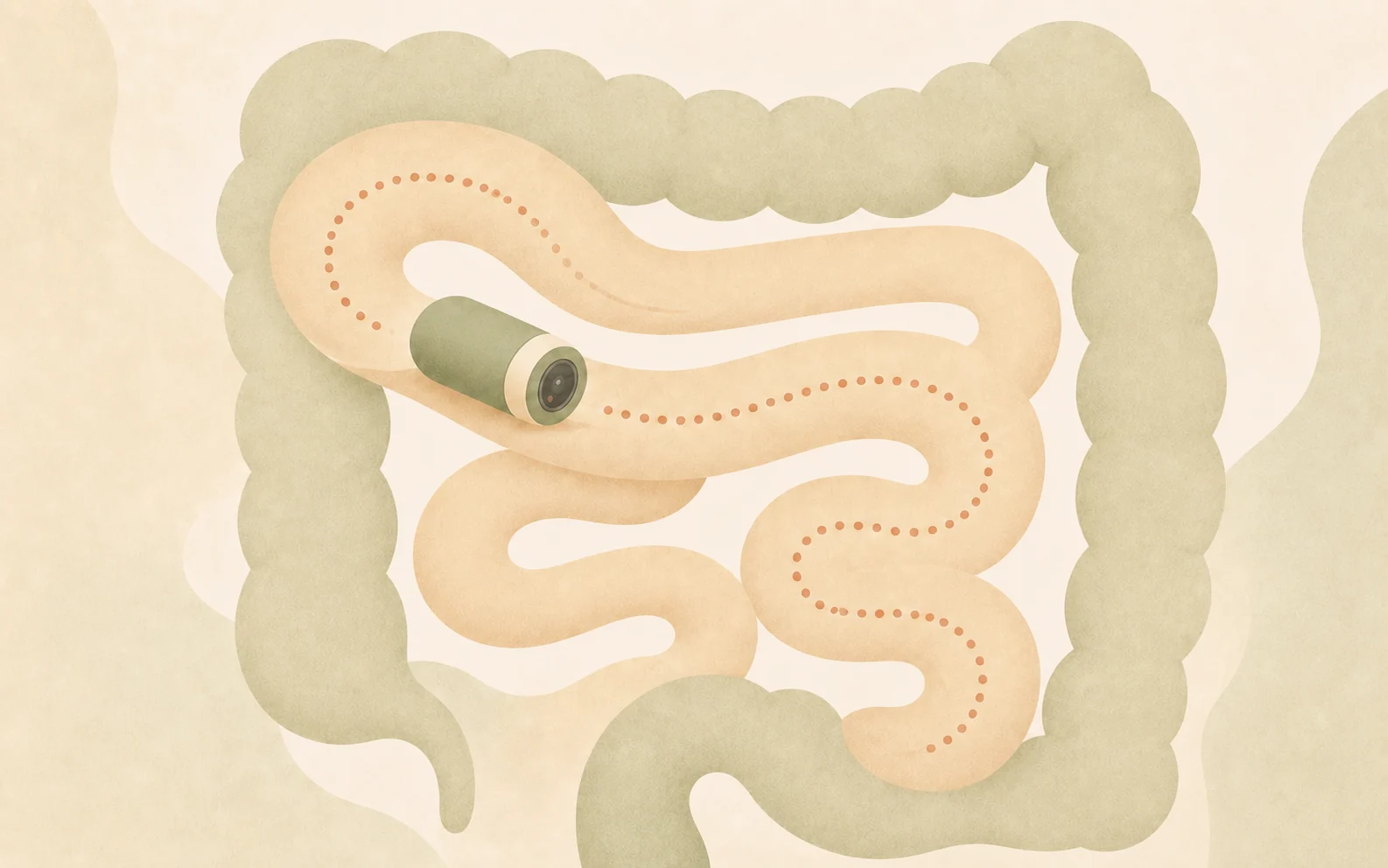 Illustration einer Kapselkamera auf ihrem Weg durch den Darm